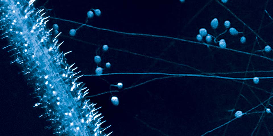 Absorptive area of mycorrhizal hyphae